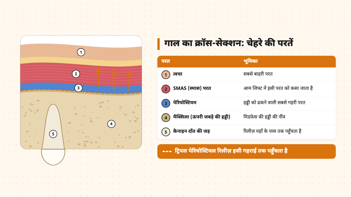 गाल का क्रॉस-सेक्शन, जिसमें त्वचा, SMAS परत, पेरियोस्टियम, मैक्सिला और कैनाइन दाँत की जड़ दिखाई गई है